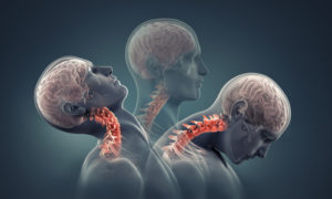 What Are The Symptoms Of A Neck Injury?