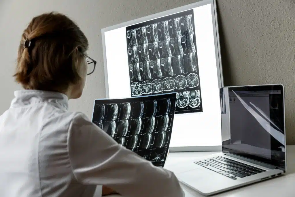 Is Locked In Syndrome Common?