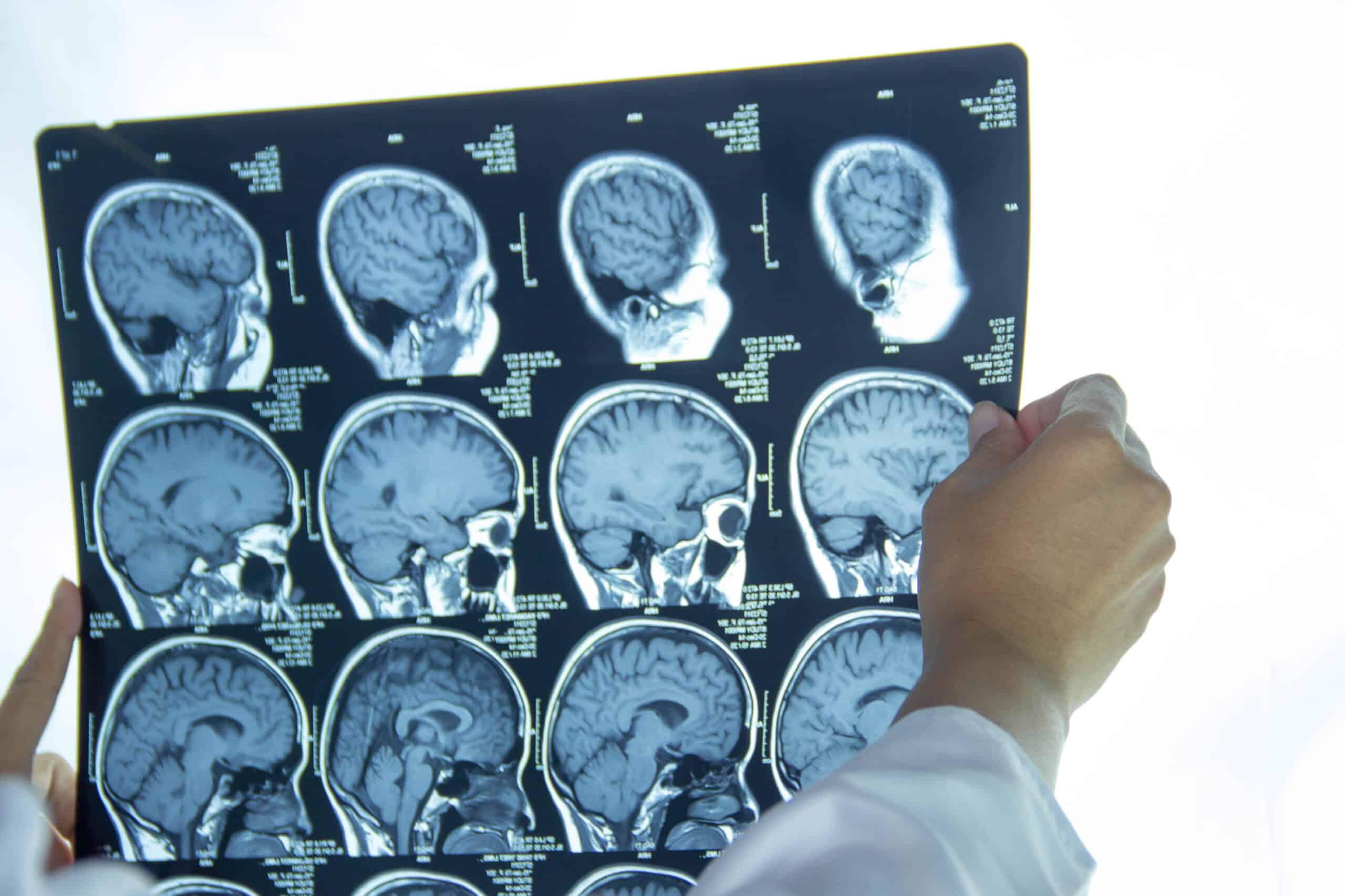 Brain Scan Close Up