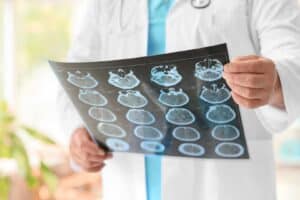 Brain Injuries Resources