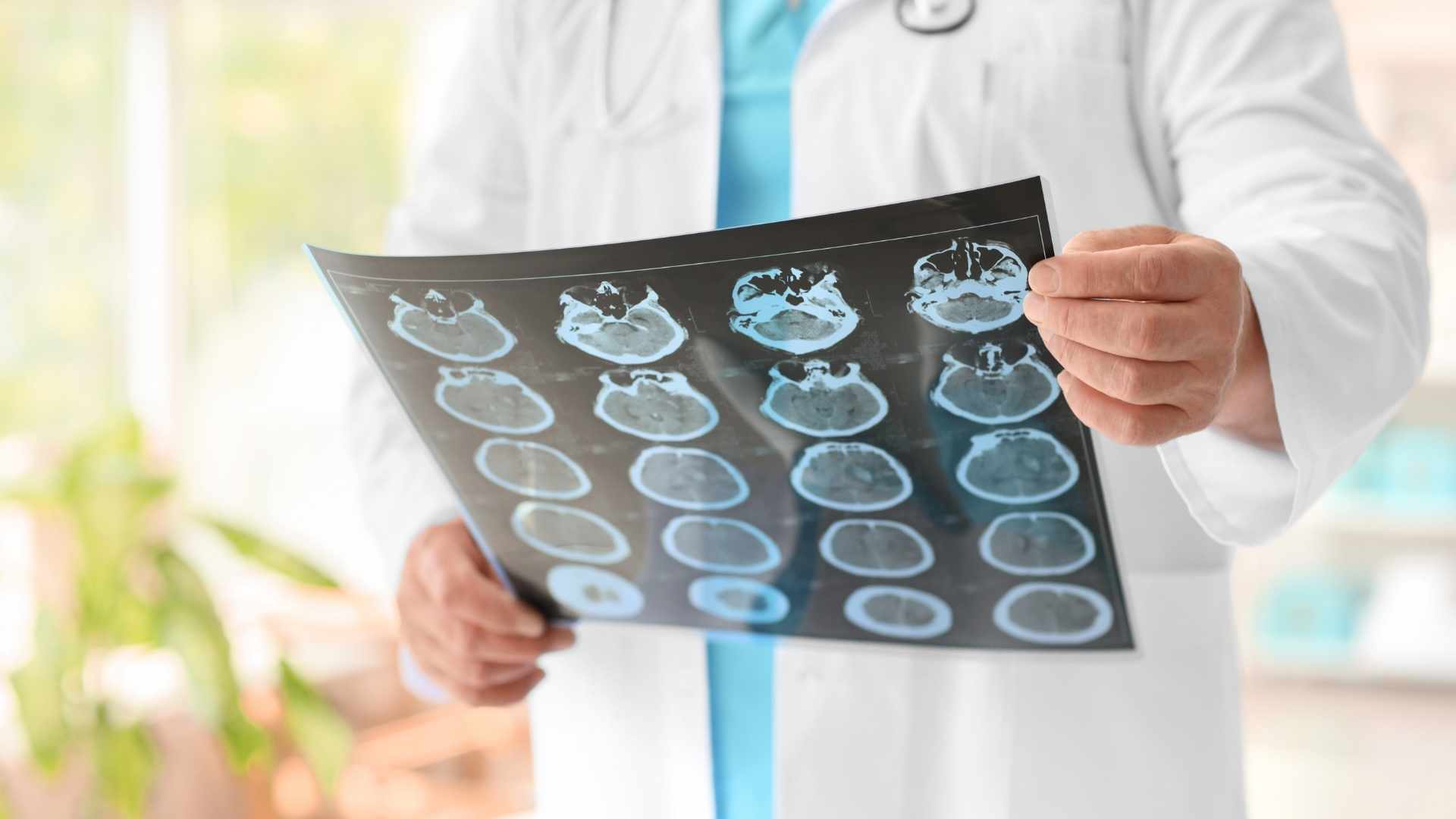 Brain Injuries Resources
