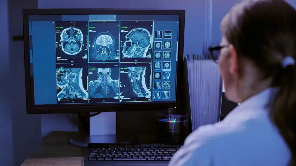 Brainstem Strokes and LIS