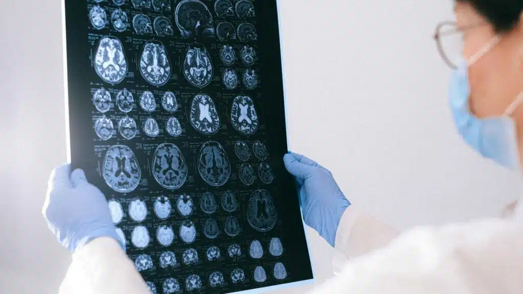 Hospital Malpractice: Rapid Sodium Correction (CPM Claims)